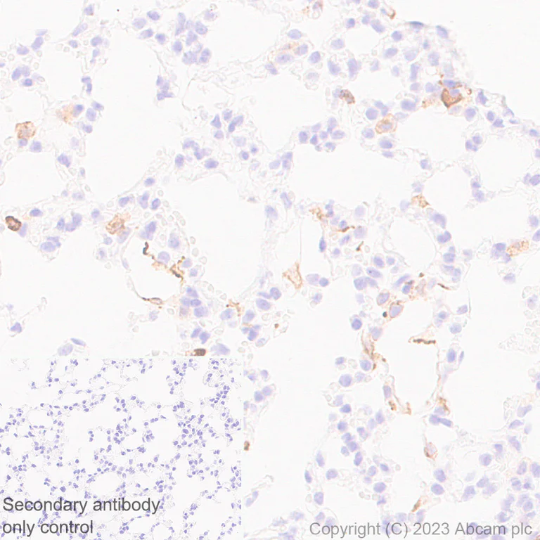 Immunohistochemistry (Formalin/PFA-fixed paraffin-embedded sections) - Anti-CD204 antibody [RM2033] (AB315834)