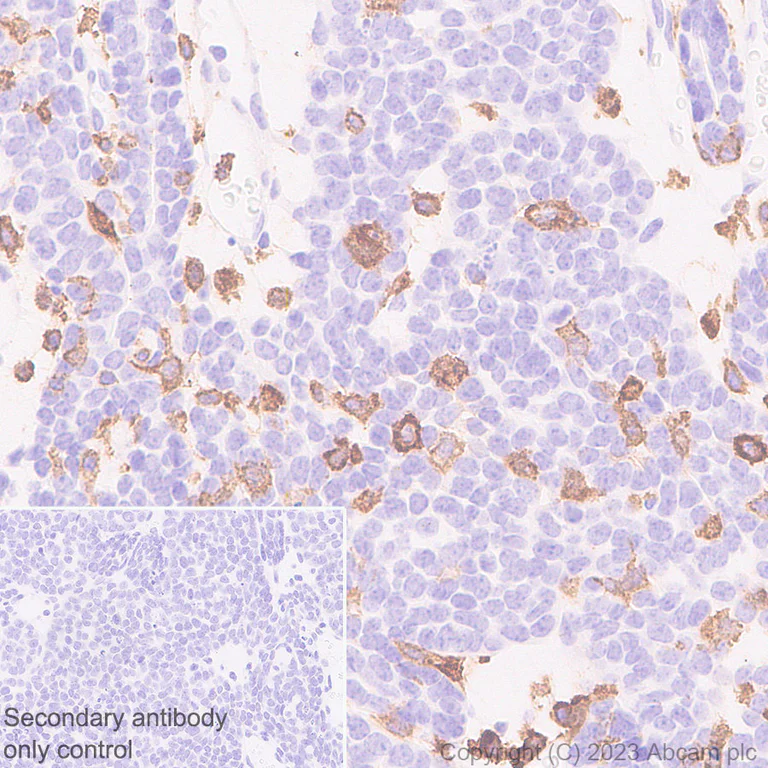 Immunohistochemistry (Formalin/PFA-fixed paraffin-embedded sections) - Anti-CD204 antibody [RM2033] (AB315834)