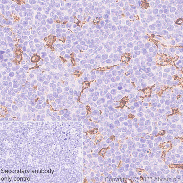 Immunohistochemistry (Formalin/PFA-fixed paraffin-embedded sections) - Anti-CD204 antibody [RM2033] (AB315834)