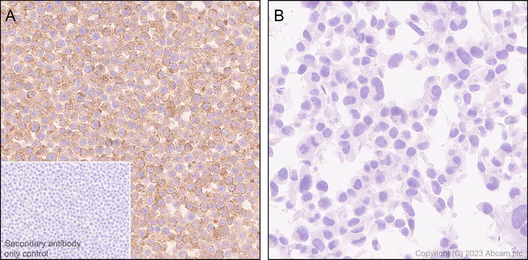 Immunohistochemistry (Formalin/PFA-fixed paraffin-embedded sections) - Anti-CD204 antibody [RM2033] (AB315834)