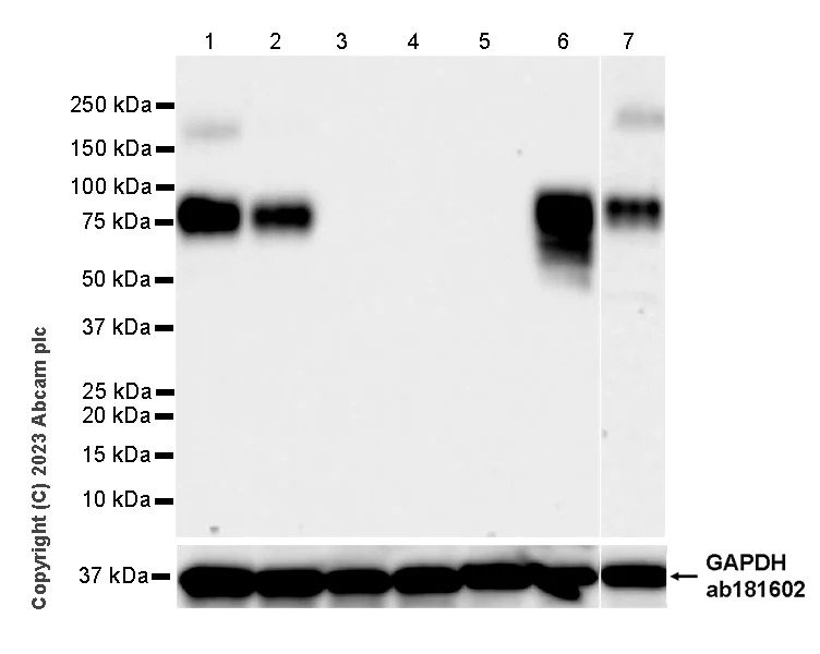 Western blot - Anti-CD204 antibody [RM2033] (AB315834)