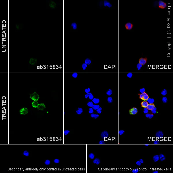 Immunocytochemistry/ Immunofluorescence - Anti-CD204 antibody [RM2033] - BSA and Azide free (AB315835)
