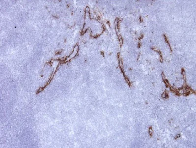 Immunohistochemistry (Frozen sections) - Anti-CD206 antibody [15-2] (AB8918)
