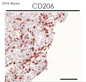 Immunohistochemistry (Frozen sections) - Anti-CD206 antibody [15-2] (AB8918)