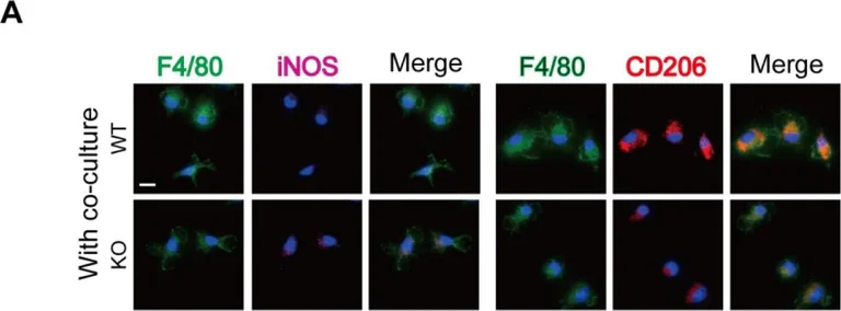Immunocytochemistry/ Immunofluorescence - Anti-CD206 antibody (AB64693)