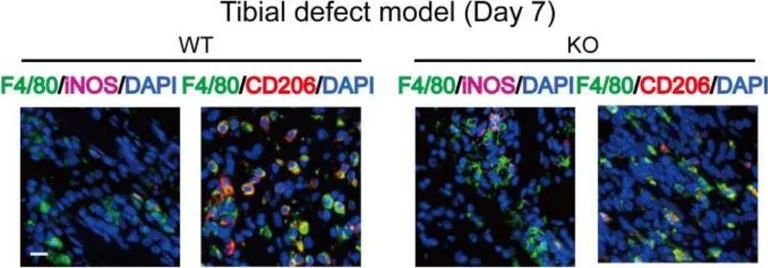 Immunocytochemistry/ Immunofluorescence - Anti-CD206 antibody (AB64693)