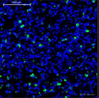 Immunohistochemistry (Formalin/PFA-fixed paraffin-embedded sections) - Anti-CD206 antibody (AB64693)