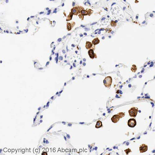 Immunohistochemistry (Formalin/PFA-fixed paraffin-embedded sections) - Anti-CD206 antibody (AB64693)