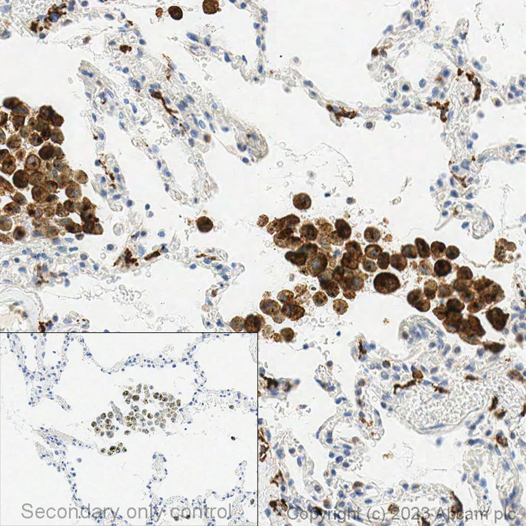 Immunohistochemistry (Formalin/PFA-fixed paraffin-embedded sections) - Anti-CD206 antibody (AB64693)