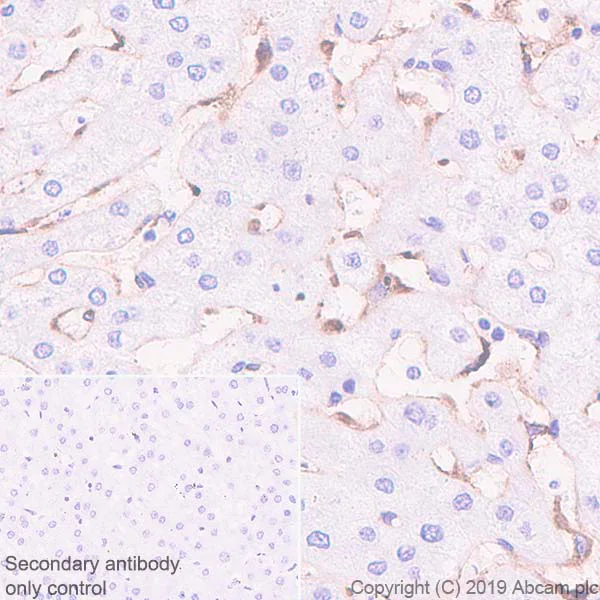 Immunohistochemistry (Formalin/PFA-fixed paraffin-embedded sections) - Anti-CD206 antibody [EPR22489-7] (AB252921)