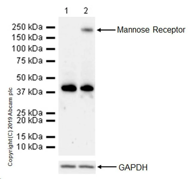 Western blot - Anti-CD206 antibody [EPR22489-7] (AB252921)