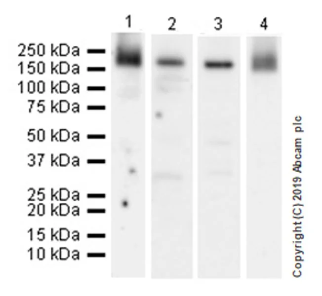 Western blot - Anti-CD206 antibody [EPR22489-7] (AB252921)