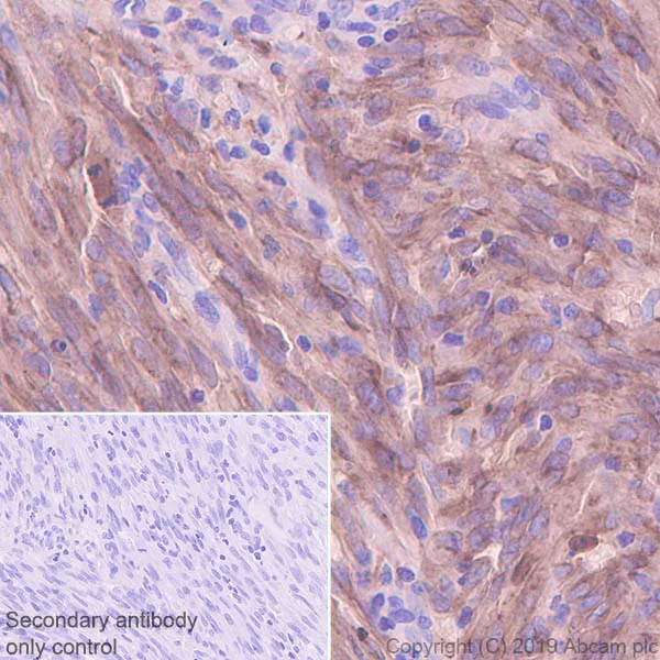 Immunohistochemistry (Formalin/PFA-fixed paraffin-embedded sections) - Anti-CD206 antibody [EPR22489-7] - BSA and Azide free (AB254471)