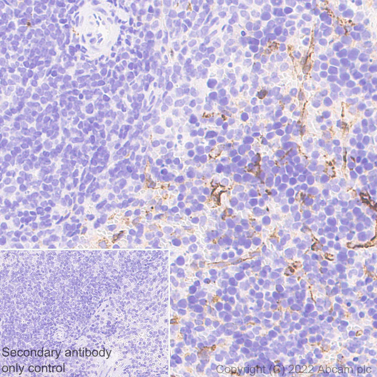 Immunohistochemistry (Formalin/PFA-fixed paraffin-embedded sections) - Anti-CD206 antibody [EPR25215-277] (AB300621)