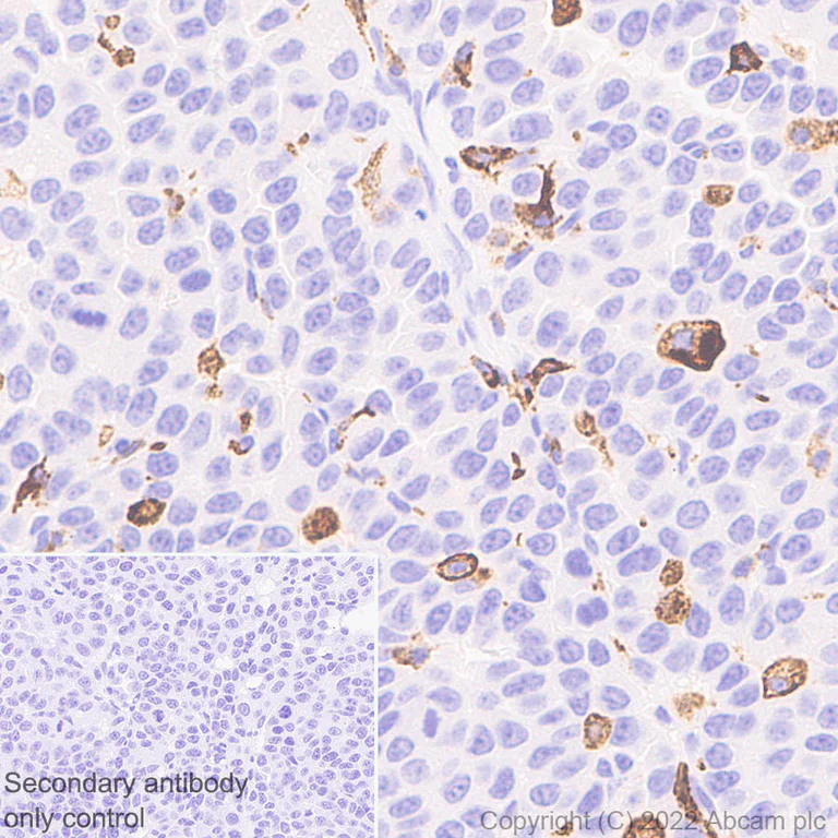 Immunohistochemistry (Formalin/PFA-fixed paraffin-embedded sections) - Anti-CD206 antibody [EPR25215-277] (AB300621)