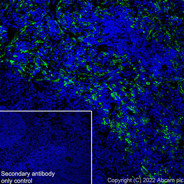 Immunohistochemistry (Frozen sections) - Anti-CD206 antibody [EPR25215-277] (AB300621)