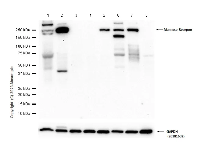 Western blot - Anti-CD206 antibody [EPR25215-277] - BSA and Azide free (AB300622)