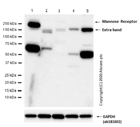 Western blot - Anti-CD206 antibody [EPR6828(B)] (AB125028)