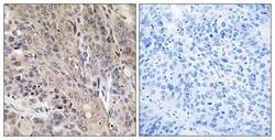 Immunohistochemistry (Formalin/PFA-fixed paraffin-embedded sections) - Anti-CD208 antibody (AB111090)