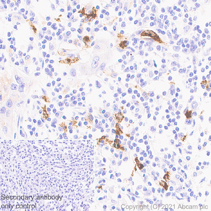 Immunohistochemistry (Formalin/PFA-fixed paraffin-embedded sections) - Anti-CD208 antibody [EPR24265-8] (AB271053), expandable thumbnail