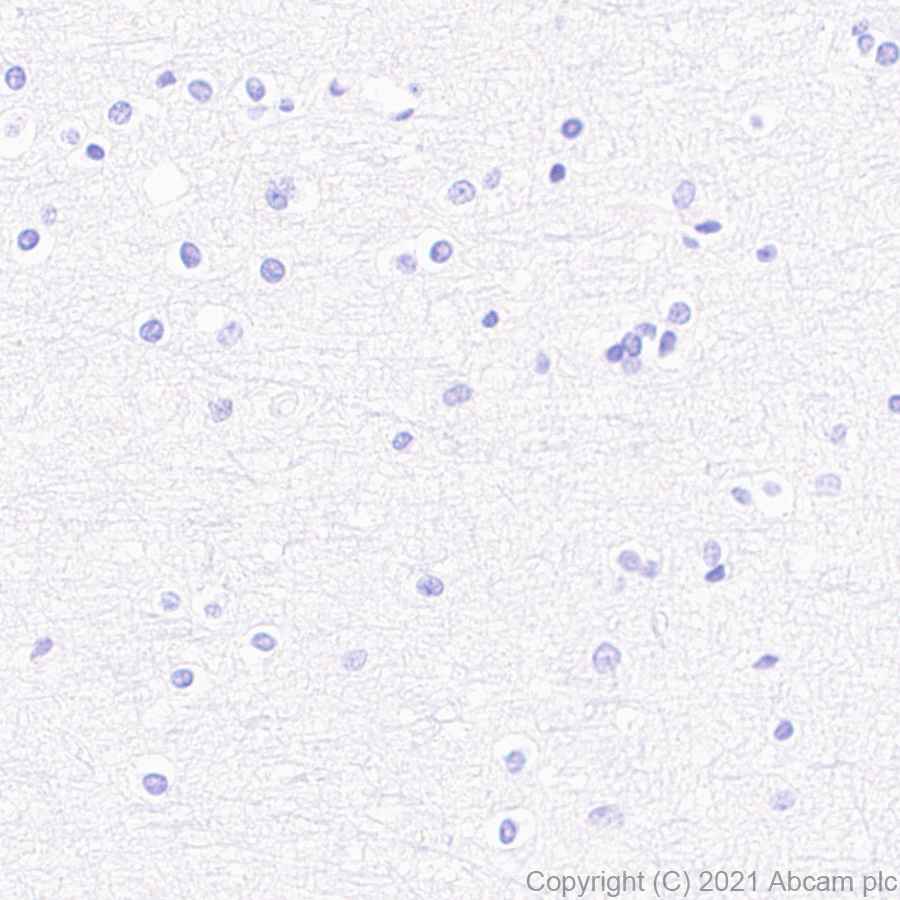 Immunohistochemistry (Formalin/PFA-fixed paraffin-embedded sections) - Anti-CD208 antibody [EPR24265-8] (AB271053), expandable thumbnail