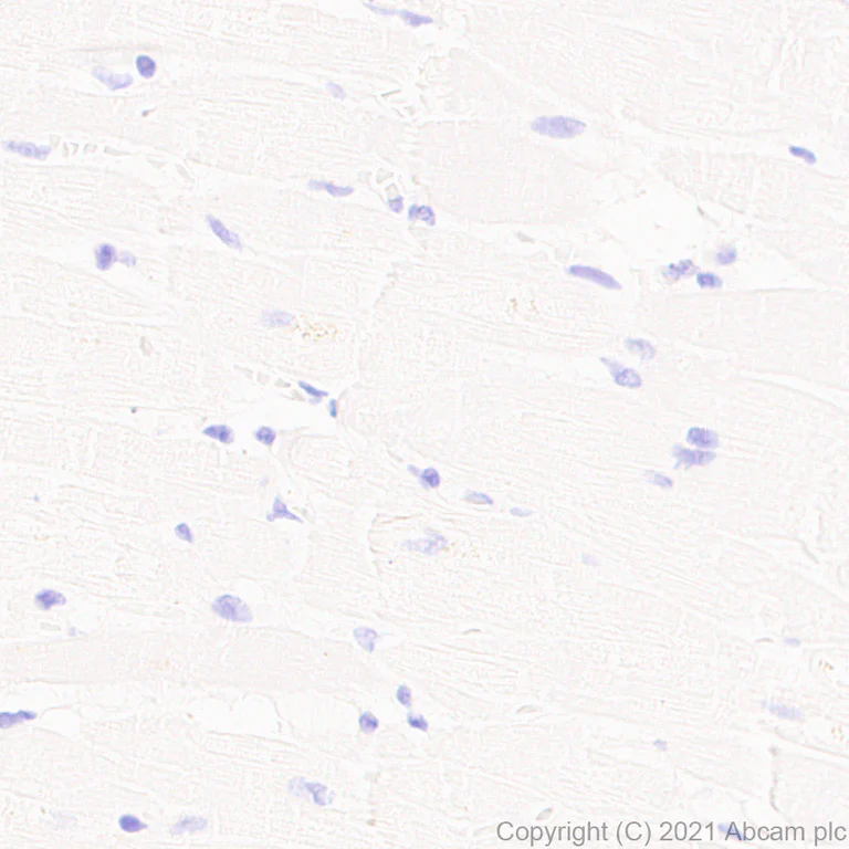 Immunohistochemistry (Formalin/PFA-fixed paraffin-embedded sections) - Anti-CD208 antibody [EPR24265-8] (AB271053)
