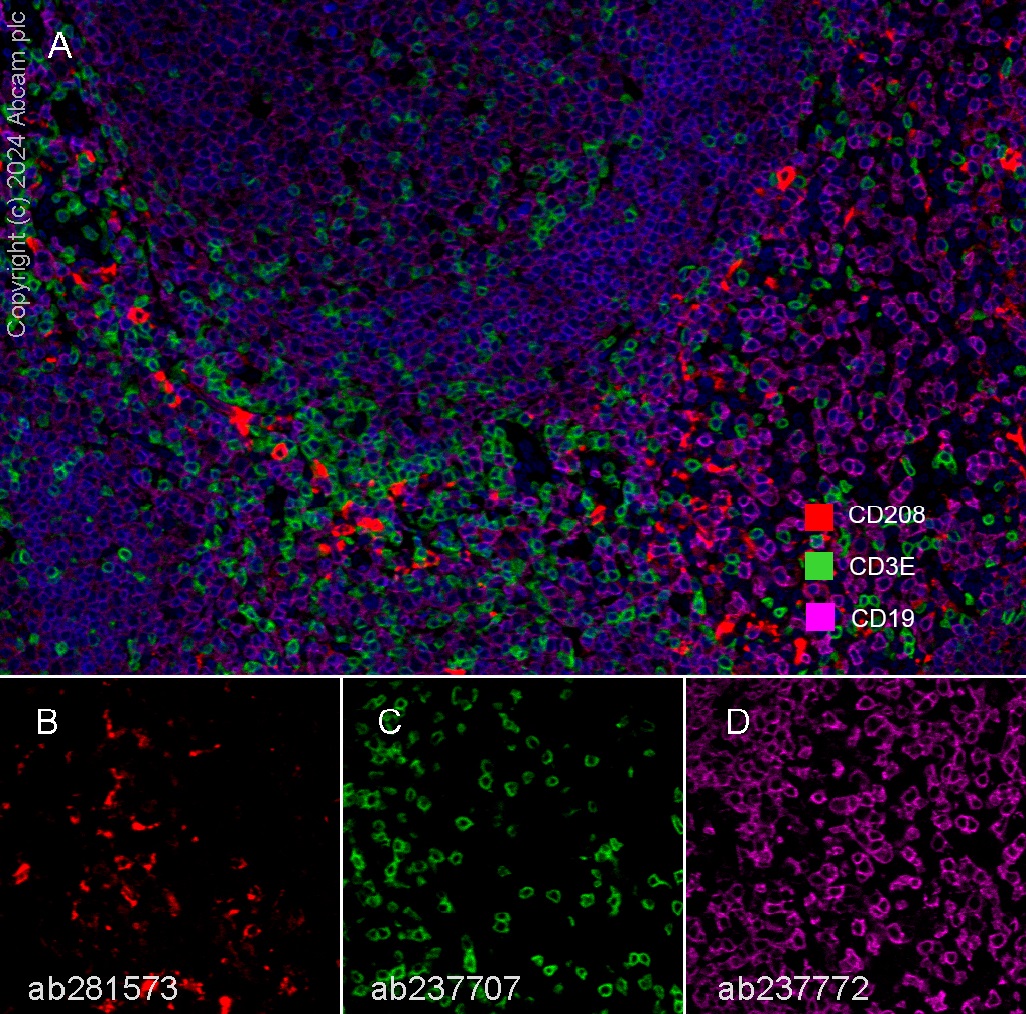 Multiplex immunohistochemistry - Anti-CD208 antibody [EPR24265-8] (ab271053), expandable thumbnail