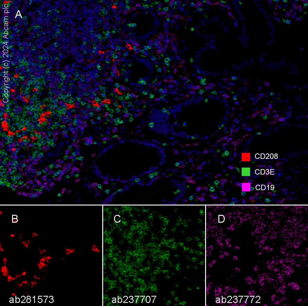 Multiplex immunohistochemistry - Anti-CD208 antibody [EPR24265-8] (ab271053), expandable thumbnail