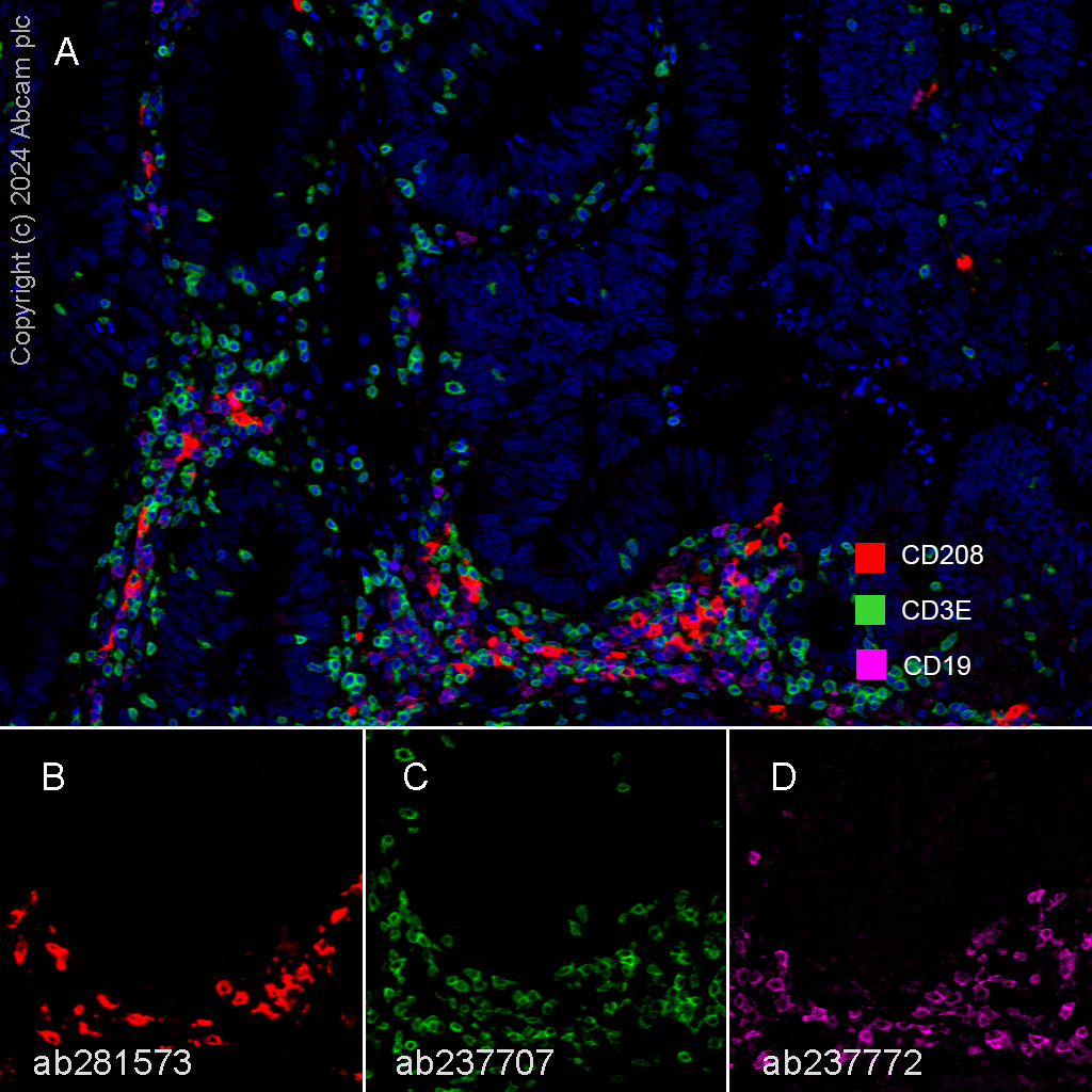 Multiplex immunohistochemistry - Anti-CD208 antibody [EPR24265-8] (ab271053), expandable thumbnail