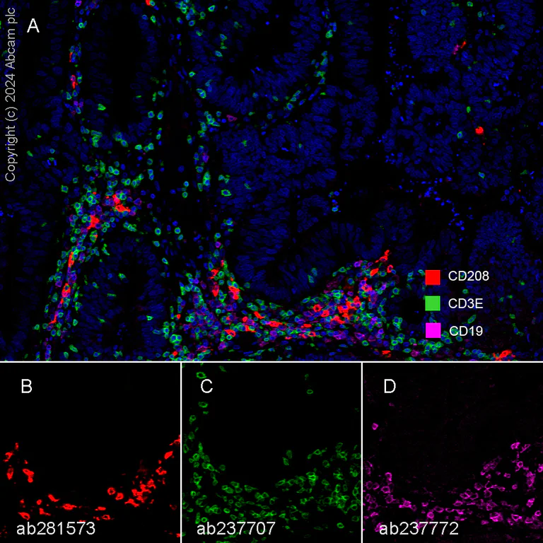Multiplex immunohistochemistry - Anti-CD208 antibody [EPR24265-8] (AB271053)