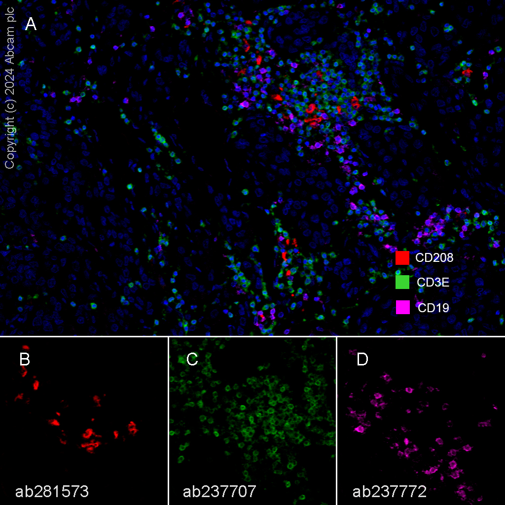 Multiplex immunohistochemistry - Anti-CD208 antibody [EPR24265-8] (ab271053), expandable thumbnail