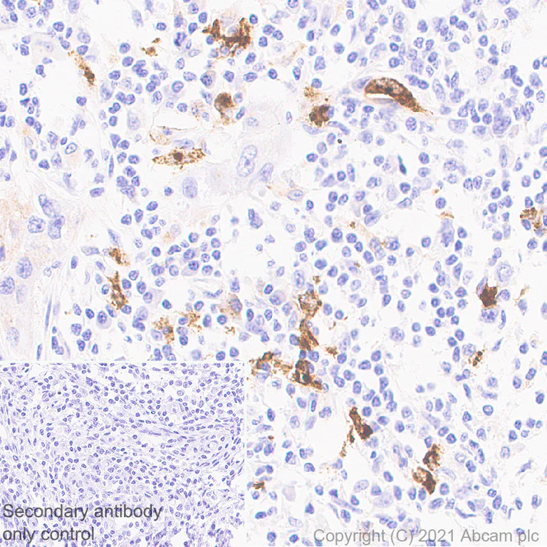 Immunohistochemistry (Formalin/PFA-fixed paraffin-embedded sections) - Anti-CD208 antibody [EPR24265-8] - BSA and Azide free (AB281573)