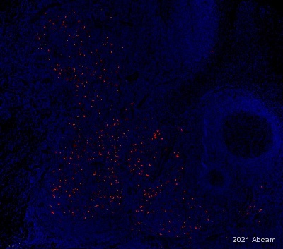 Immunohistochemistry (Formalin/PFA-fixed paraffin-embedded sections) - Anti-CD208 antibody [EPR24265-8] - BSA and Azide free (ab281573), expandable thumbnail