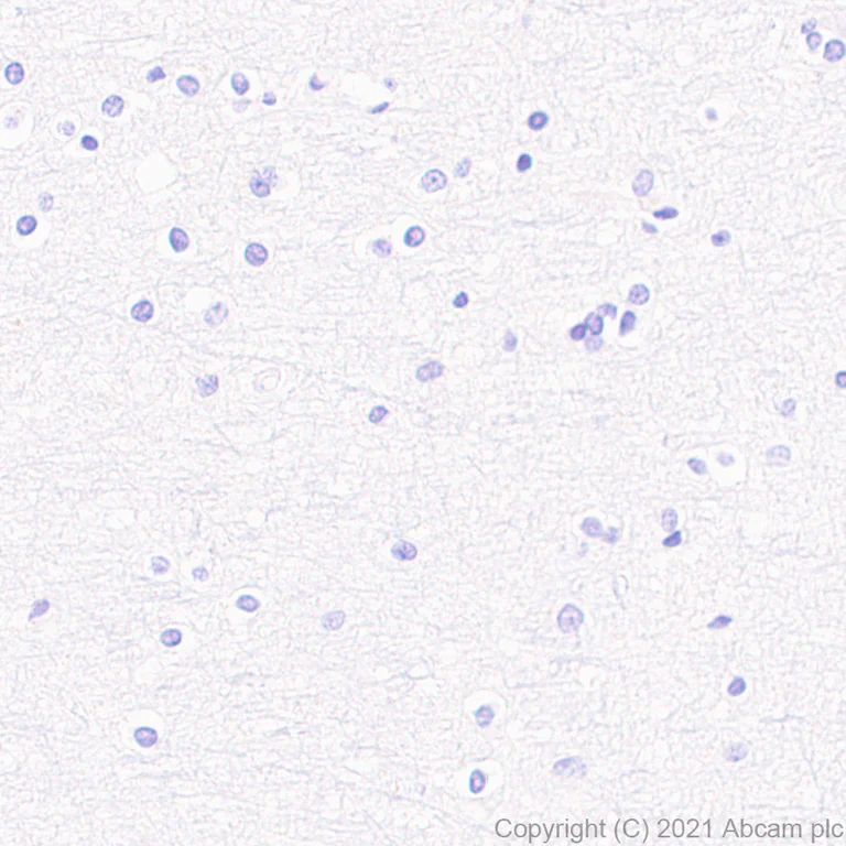 Immunohistochemistry (Formalin/PFA-fixed paraffin-embedded sections) - Anti-CD208 antibody [EPR24265-8] - BSA and Azide free (AB281573)