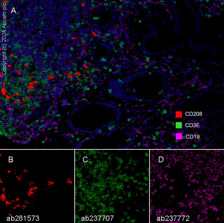Multiplex immunohistochemistry - Anti-CD208 antibody [EPR24265-8] - BSA and Azide free (AB281573)