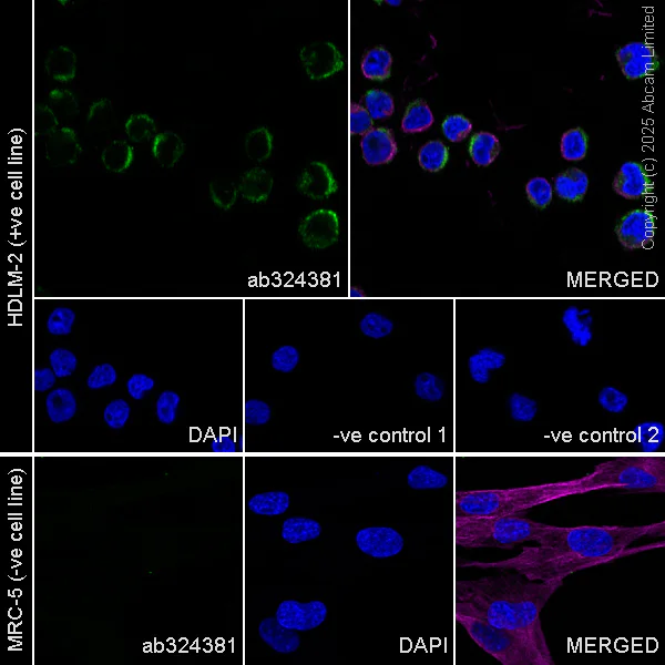 Immunocytochemistry/ Immunofluorescence - Anti-CD208 antibody [EPR27972-137] (AB324381)