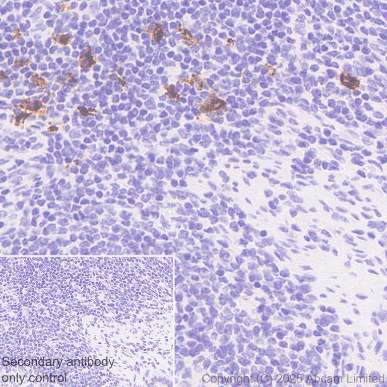 Immunohistochemistry (Formalin/PFA-fixed paraffin-embedded sections) - Anti-CD208 antibody [EPR27972-137] (AB324381)