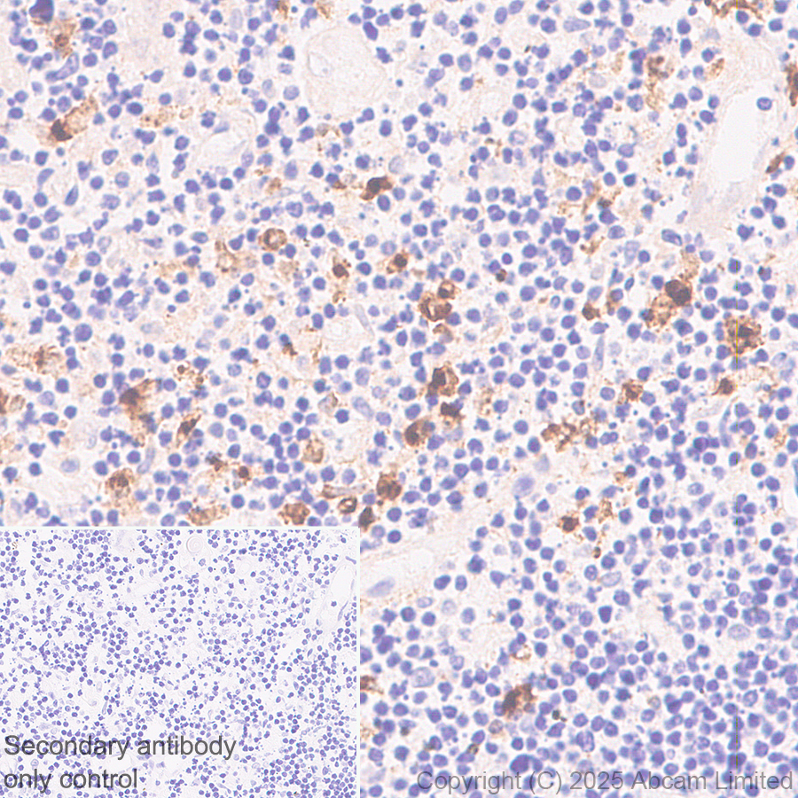 Anti-CD208 antibody [EPR27972-137] (ab324381) | Abcam