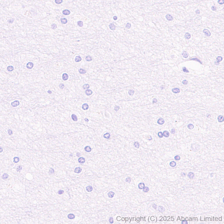 Immunohistochemistry (Formalin/PFA-fixed paraffin-embedded sections) - Anti-CD208 antibody [EPR27972-137] (AB324381)