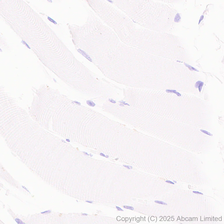 Immunohistochemistry (Formalin/PFA-fixed paraffin-embedded sections) - Anti-CD208 antibody [EPR27972-137] (AB324381)