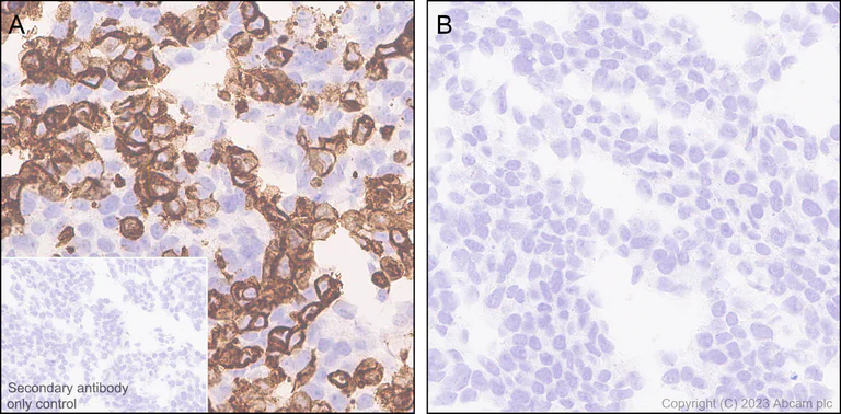 Immunohistochemistry (Formalin/PFA-fixed paraffin-embedded sections) - Anti-CD209B/DC-SIGNR1 antibody [EPR27427-87] (AB308457)
