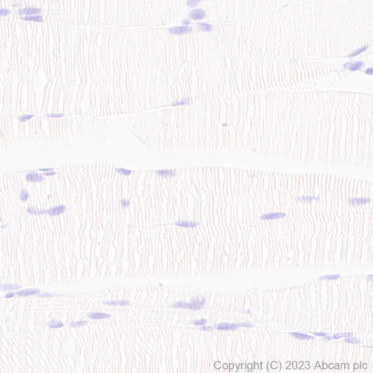 Immunohistochemistry (Formalin/PFA-fixed paraffin-embedded sections) - Anti-CD209B/DC-SIGNR1 antibody [EPR27427-87] (AB308457)