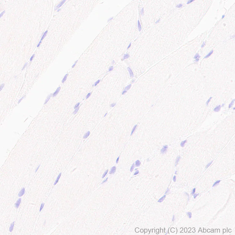 Immunohistochemistry (Formalin/PFA-fixed paraffin-embedded sections) - Anti-CD209B/DC-SIGNR1 antibody [EPR27427-87] (AB308457)