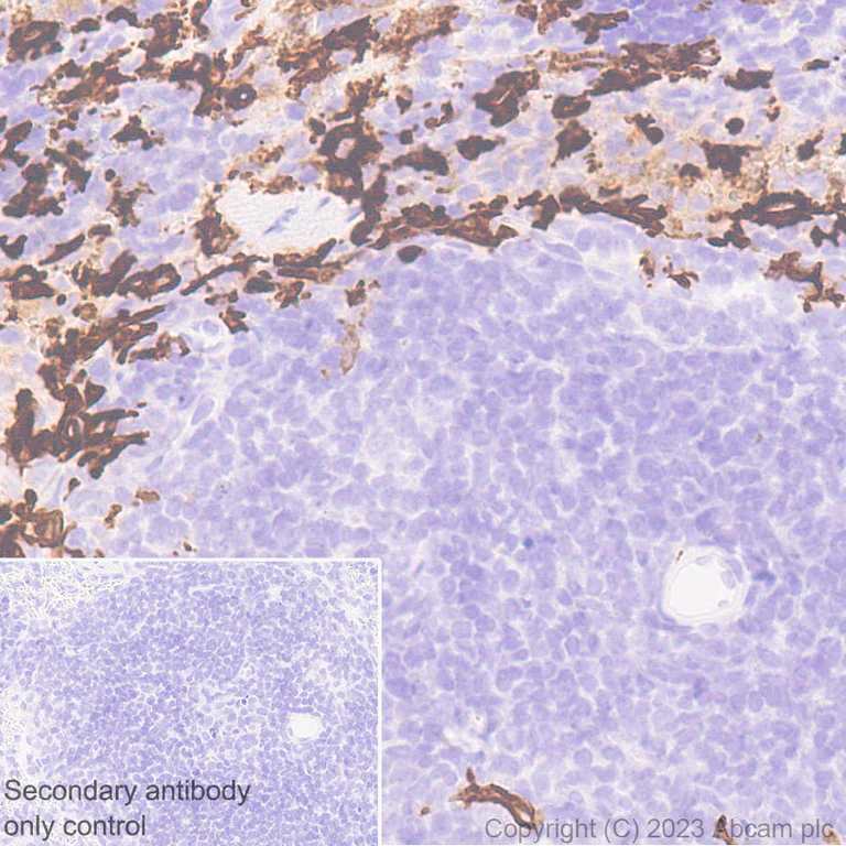 Immunohistochemistry (Formalin/PFA-fixed paraffin-embedded sections) - Anti-CD209B/DC-SIGNR1 antibody [EPR27427-87] (AB308457)