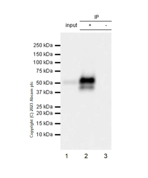 Immunoprecipitation - Anti-CD209B/DC-SIGNR1 antibody [EPR27427-87] (AB308457)