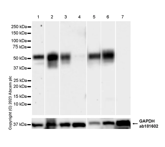 Western blot - Anti-CD209B/DC-SIGNR1 antibody [EPR27427-87] (AB308457)