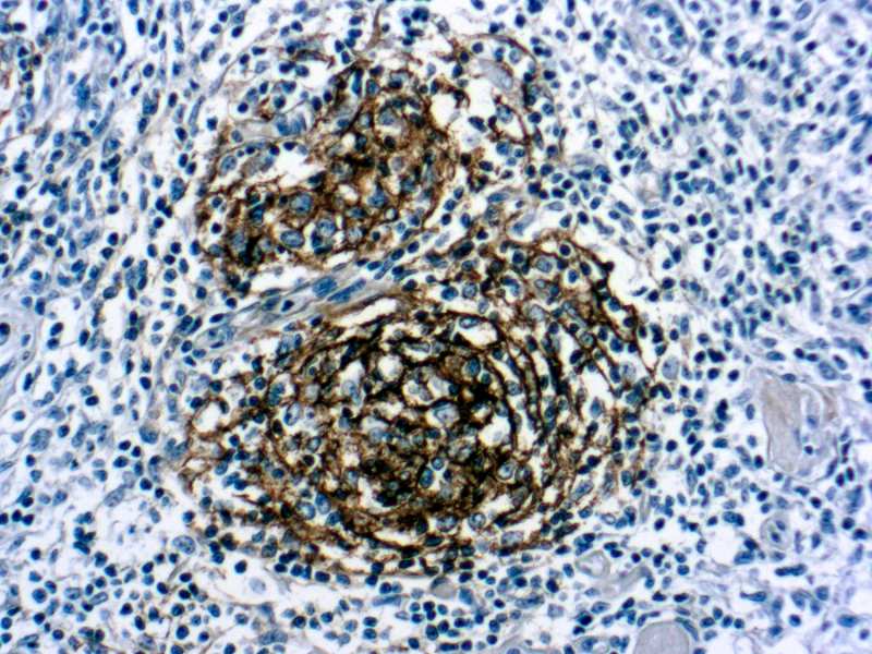 Immunohistochemistry (Formalin/PFA-fixed paraffin-embedded sections) - Anti-CD21 antibody [1F8], prediluted (AB7290)