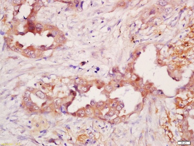 Immunohistochemistry (Formalin/PFA-fixed paraffin-embedded sections) - Anti-CD21 antibody - C-terminal (AB203299)