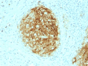 Immunohistochemistry (Formalin/PFA-fixed paraffin-embedded sections) - Anti-CD21 antibody [CR2/1953] (AB237981), expandable thumbnail