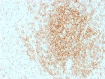 Immunohistochemistry (Formalin/PFA-fixed paraffin-embedded sections) - Anti-CD21 antibody [CR2/1953] (AB237981), expandable thumbnail